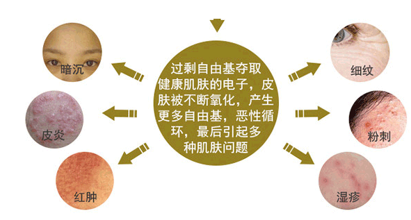 負(fù)氧離子