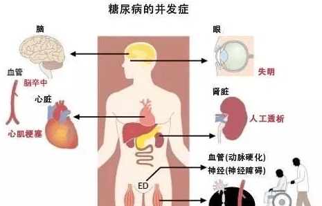 負(fù)離子