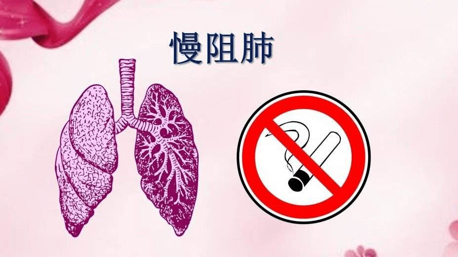負(fù)氧離子